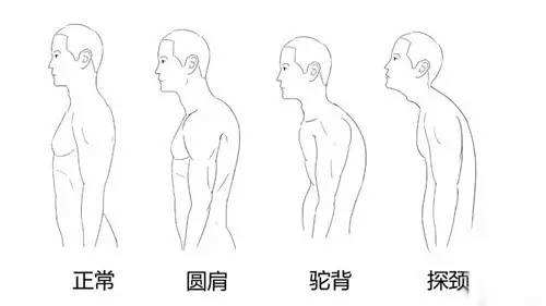 正常非正常颈椎