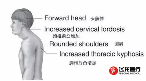 脊柱健康，不向生活“低头”